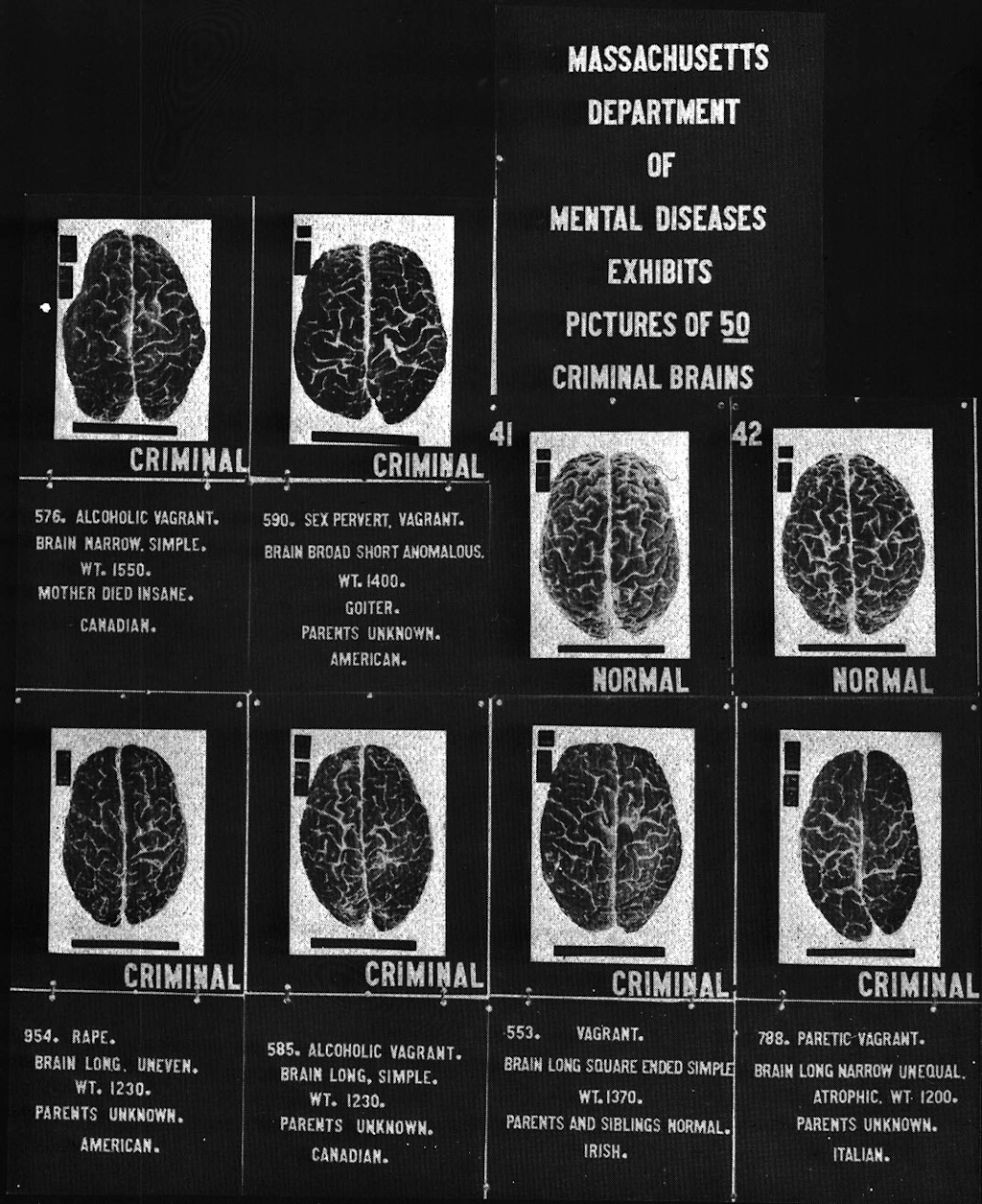A 1920s image of various criminal brains - Credit: Pennsylvania State University Libraries